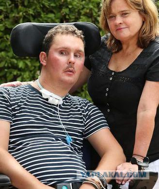 Подросток съел на спор слизняка, подхватил мозгового червя и умер