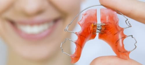 Таймлапс работы зубных брекетов
