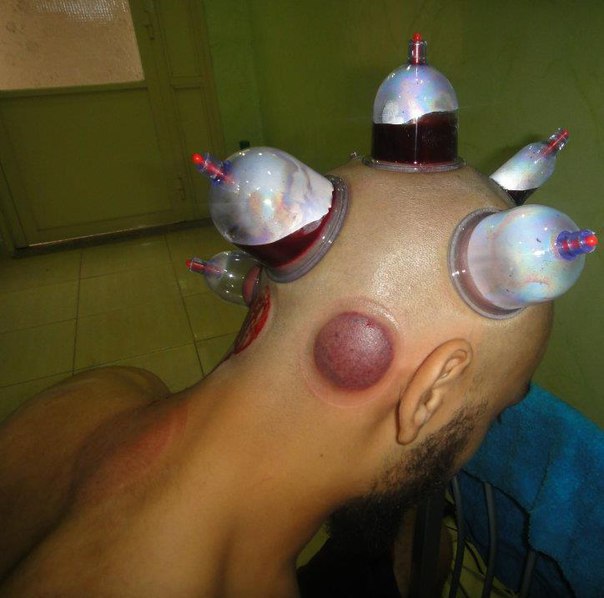 Ужасы и приколы из соцсетей 18+