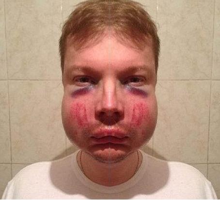 Ай Беркут красава, ввалил правосекам.