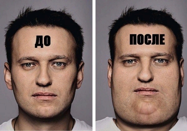 Алексей Навальный объявил голодовку в колонии