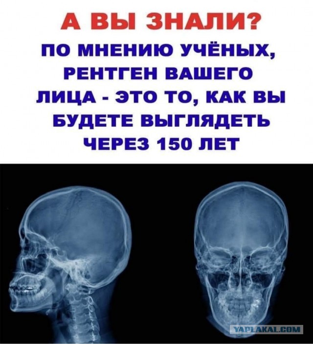 Бредзона 10.03.21