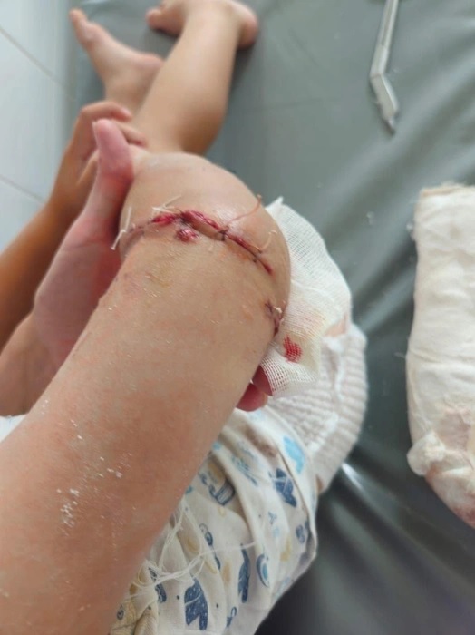 В России расширят список опасных пород собак