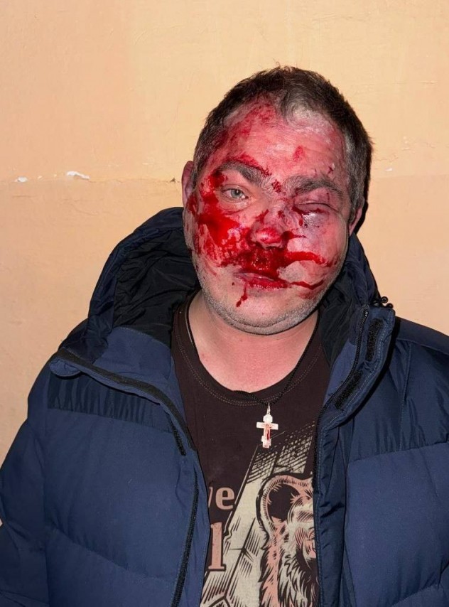В Крыму избили посетителей кафе