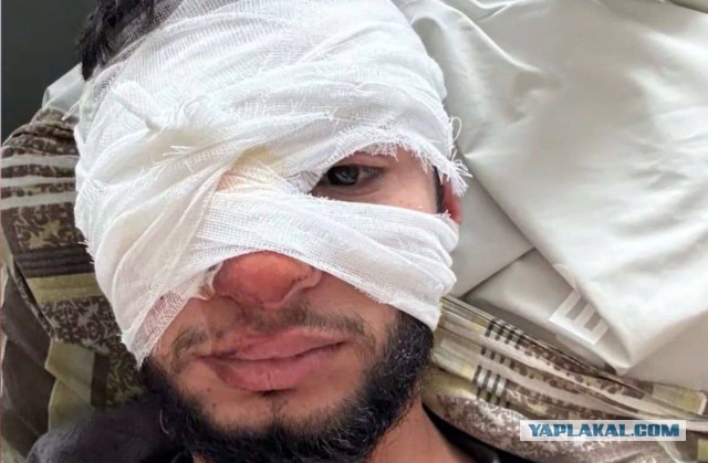 Париж: Украина может применять ракеты SCALP для ударов по РФ