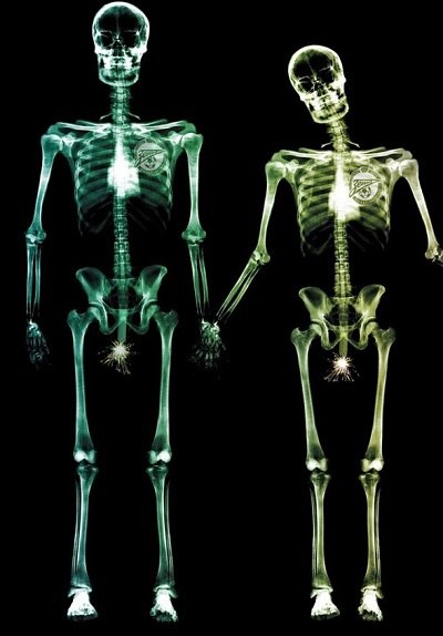 Доренко о внутриполостном Зените