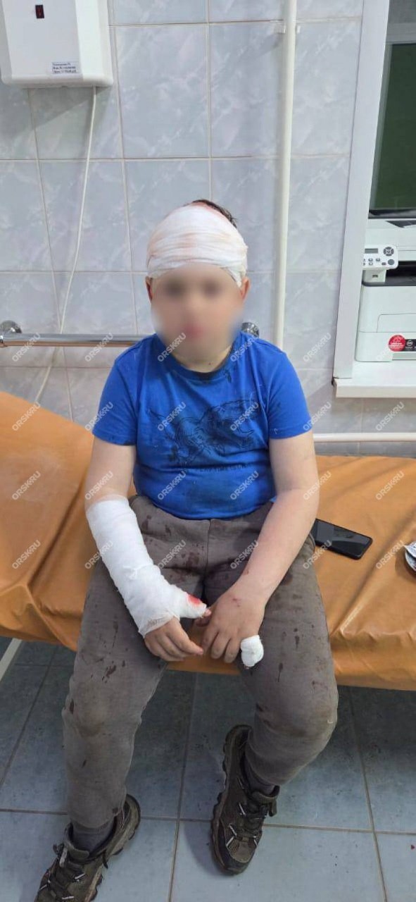 Под Орском огромный бродячий алабай попытался отгрызть голову школьнику