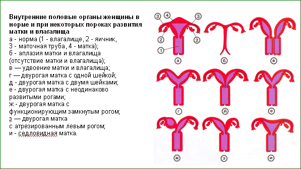 Женщины с двумя вагинами и другие аномалии половых органов