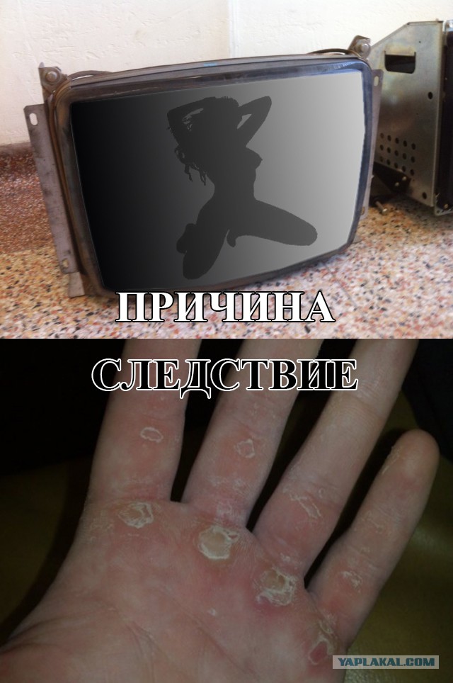 Экран фигурно выгорел