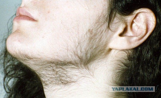 Гендерные различия