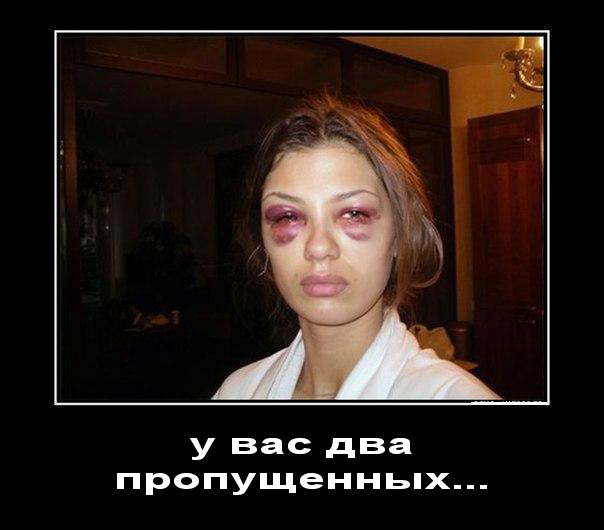 Синяк