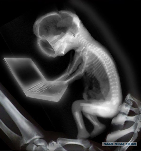 Психиатры считают подозрительным,