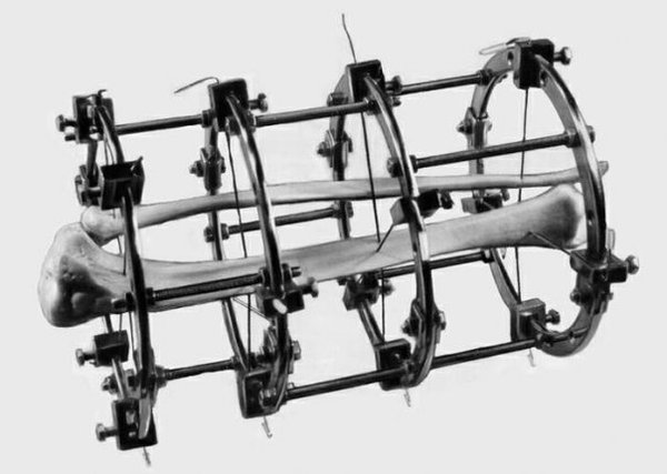 Бабка. Рассказы врача