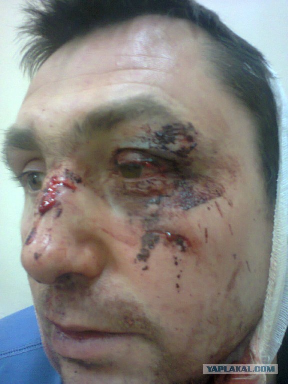 Опять национальный конфликт (в Муроме)