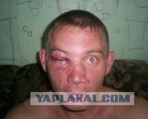 Попрыгунчик и подстава!