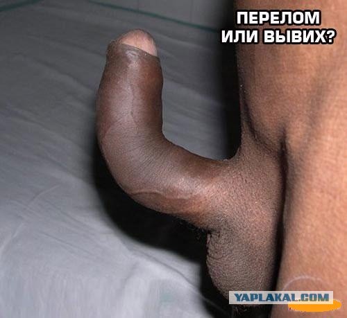 Мужчины, а как вы носите трусы?