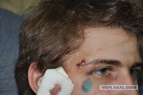 ОМОН крепит красные мокасины