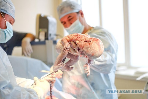 Так начинается жизнь