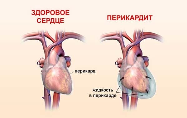 Пандемия. Коронавирус. Россия и мир. Последняя информация. Часть 27