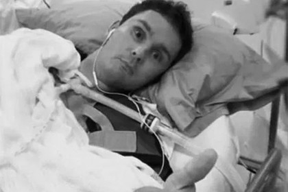 Подросток съел на спор слизняка, подхватил мозгового червя и умер