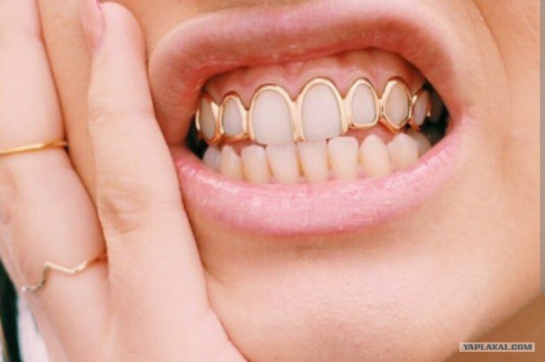 Желтые зубы во сне. Желтые зубы во сне. Желтоватые зубы улыбка. Желтые зубы во сне. Желтые зубы во сне.