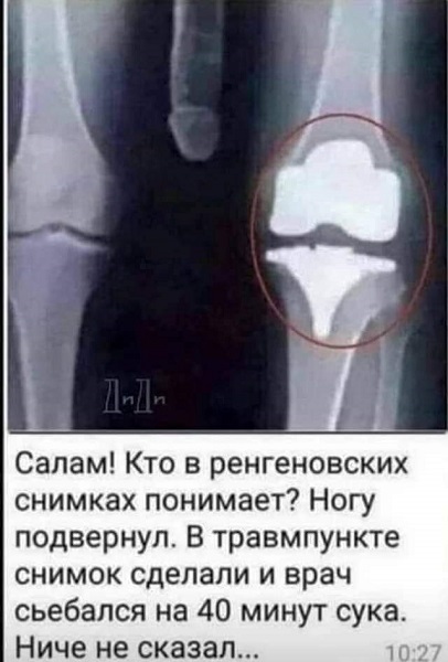 С миру по нитке 27.11