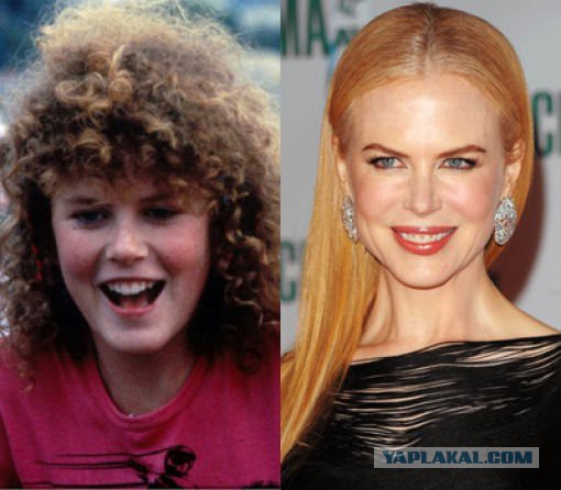 Знаменитости, которые безобразно стареют