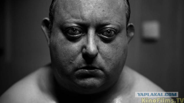 "Врач"добивал ополченцев на операционном столе
