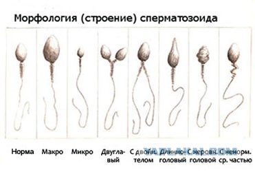 Спермограмма