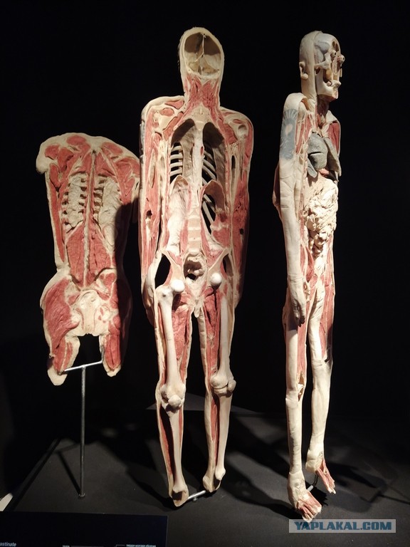 Посетил выставку Body Worlds на ВДНХ