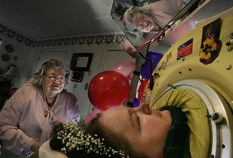 Жизнь в «танке»: женщина провела почти 60 лет в аппарате вентиляции легких