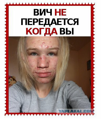 ВИЧ не передается...