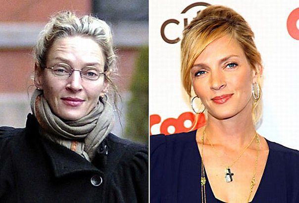 Знаменитости, которые безобразно стареют