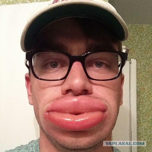 Ну и ну! Ей пришили ж@пу бабуина!