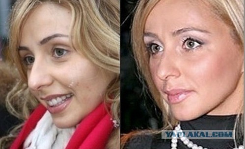 Навка: «Если Загитова стала олимпийской чемпионкой, то у нее получится быть депутатом»