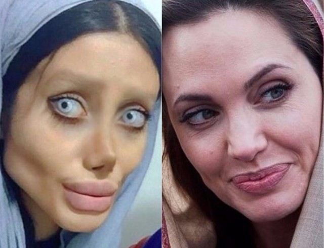 Подтянула личико