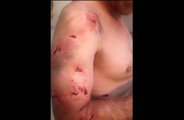 «Удар кувалды с зубами»: американец записал видео после двойного нападения гризли