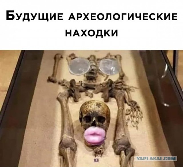 Губошлепка с самыми огромными губами захотела их еще больше увеличить