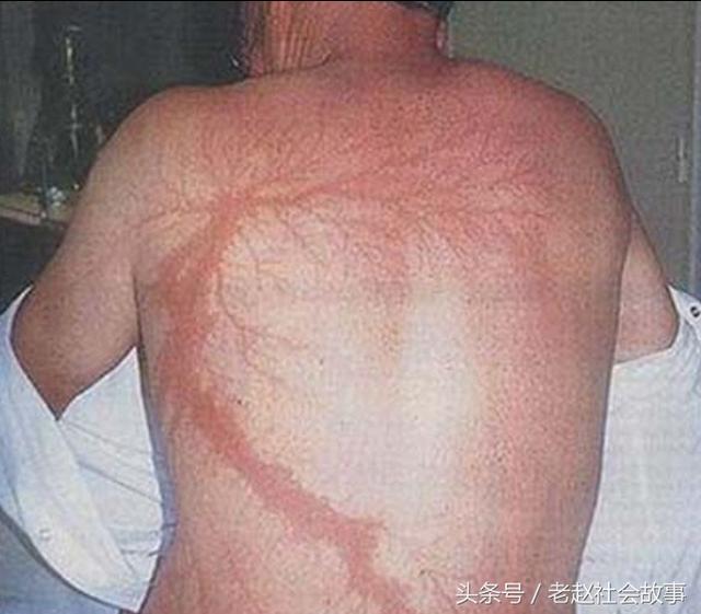 Молния ударила в дерево