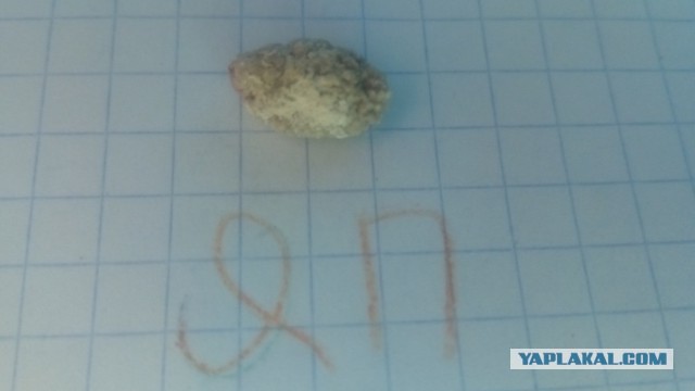 Про медицину в Турции или ты хуже кошки