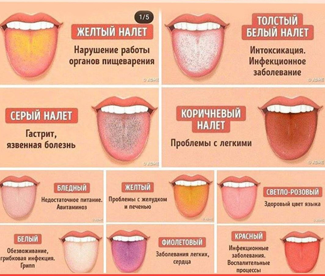 Сухость во рту при диете быстро Сухость во рту при диете быстро