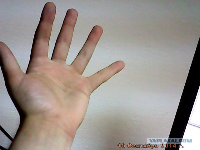 15 фактов про МПХ