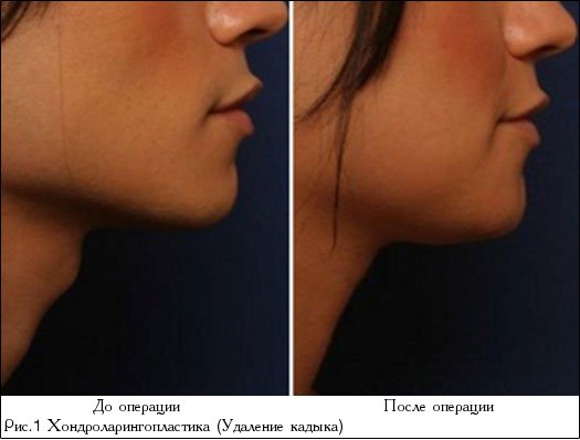 Когда счастье казалось так близко