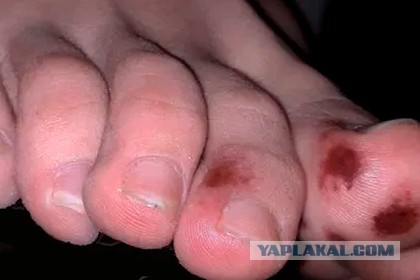 Итоговый обзор на Ковид-19