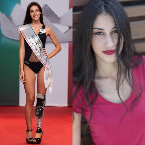 Вице-Мисс Италия-2018 стала девушка без ноги