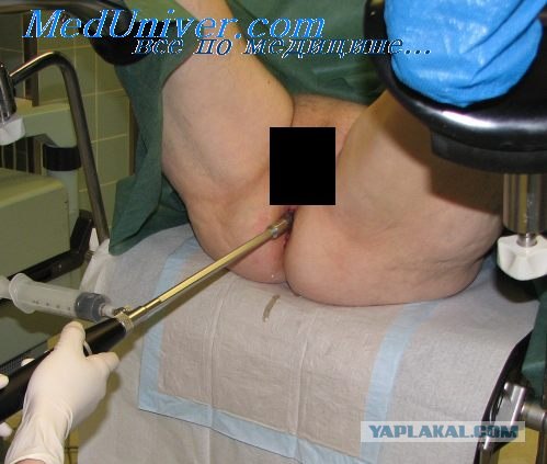 Кольцо из метеорита