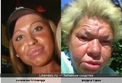 Правда о том, зачем увеличивают губы