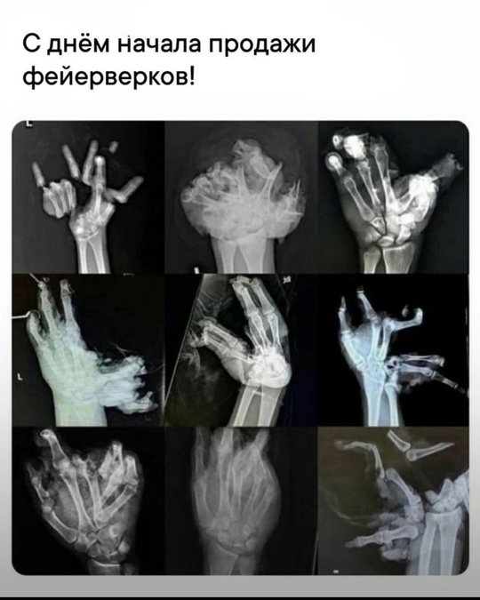 Весёлый полтишок 29.12.24