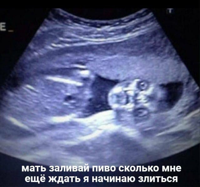 Для чего дошёл прогресс