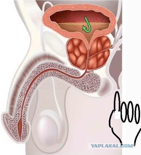Когда «само пройдет» не работает: правда о простатите и аденоме простаты
